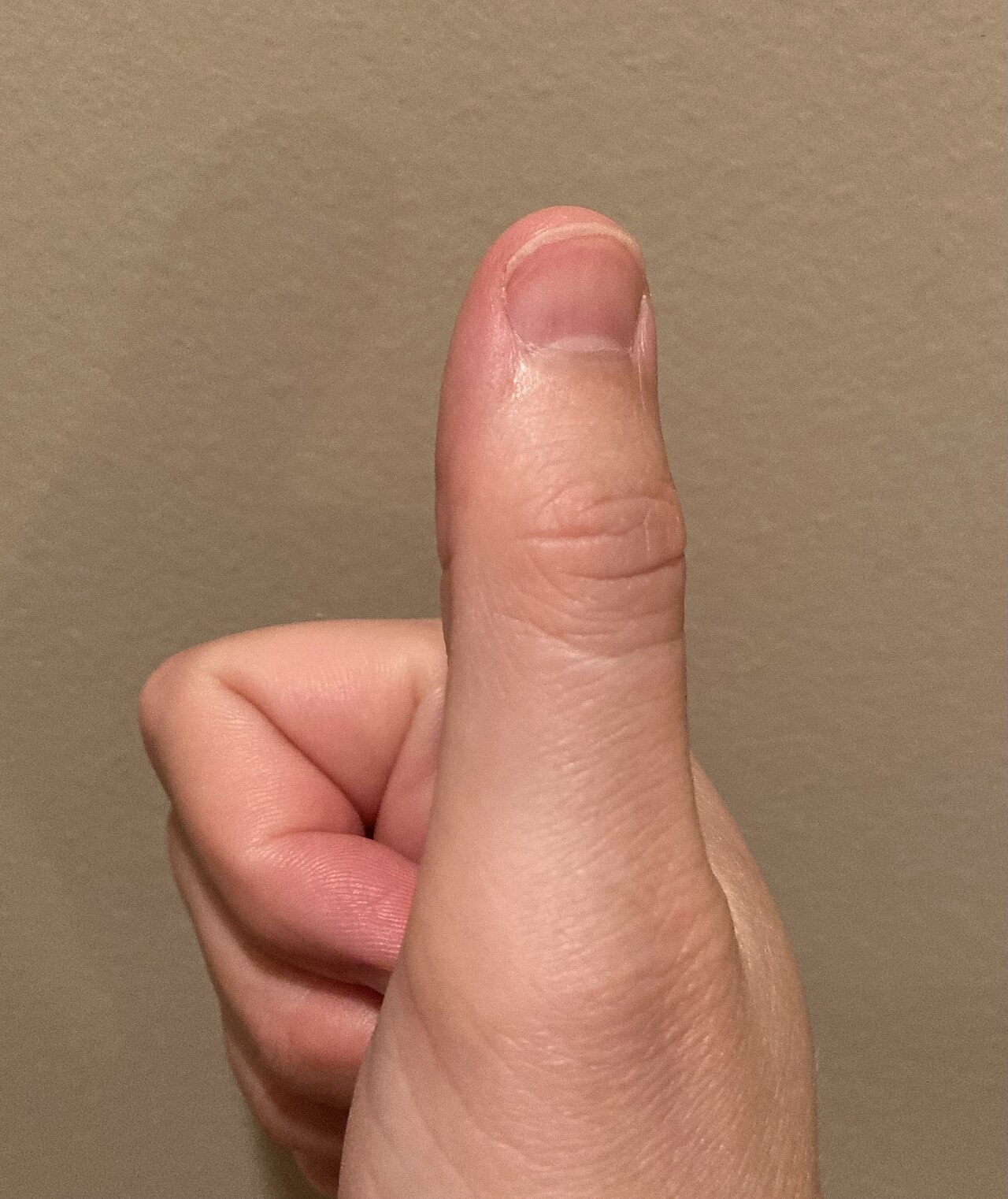 The Thumb's Unique Anatomy: How it Differs from Your Fingers